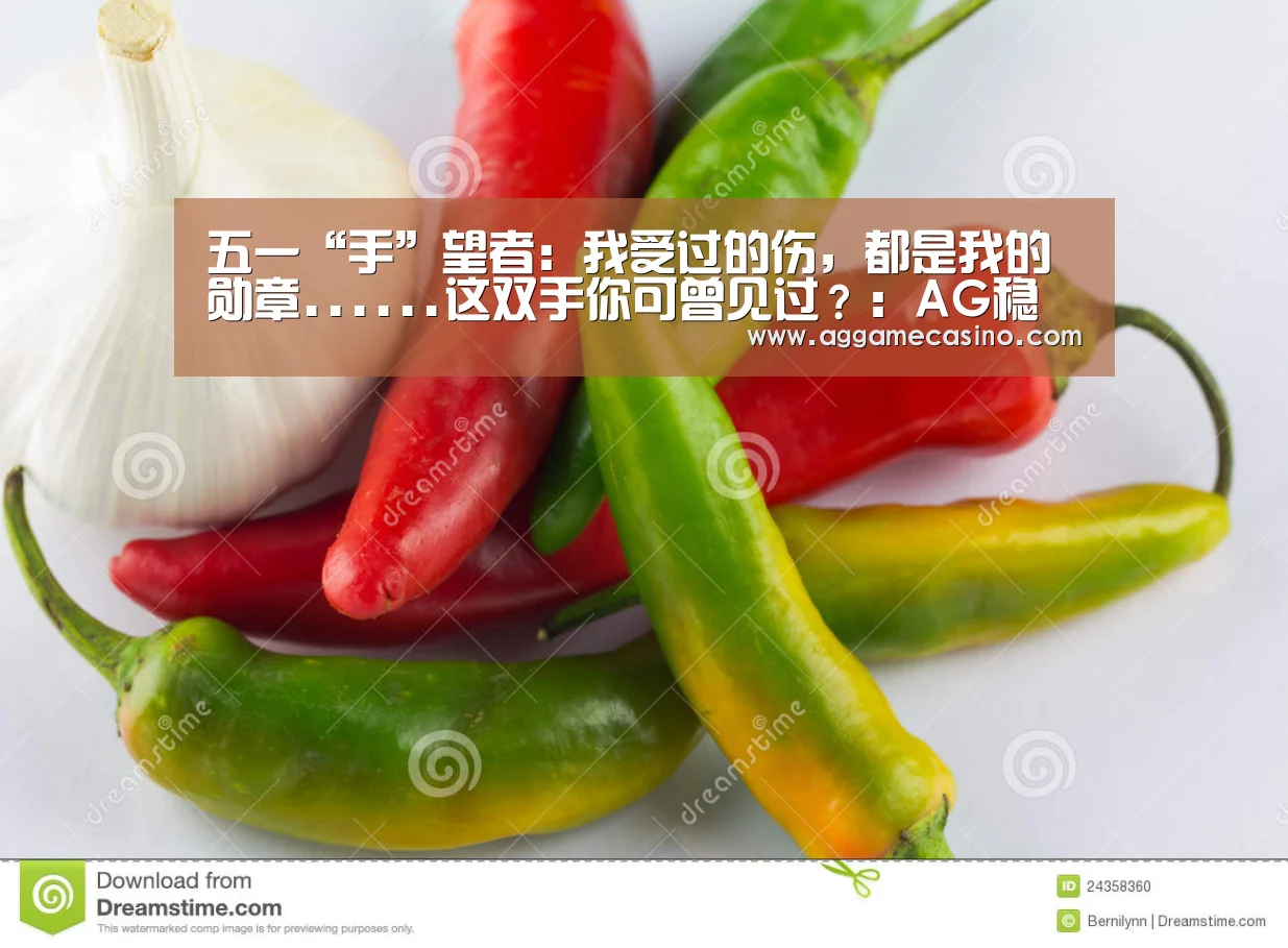 五一“手”望者:我受过的伤,都是我的勋章......这双手你可曾见过?:AG稳定(图1) AG游艺